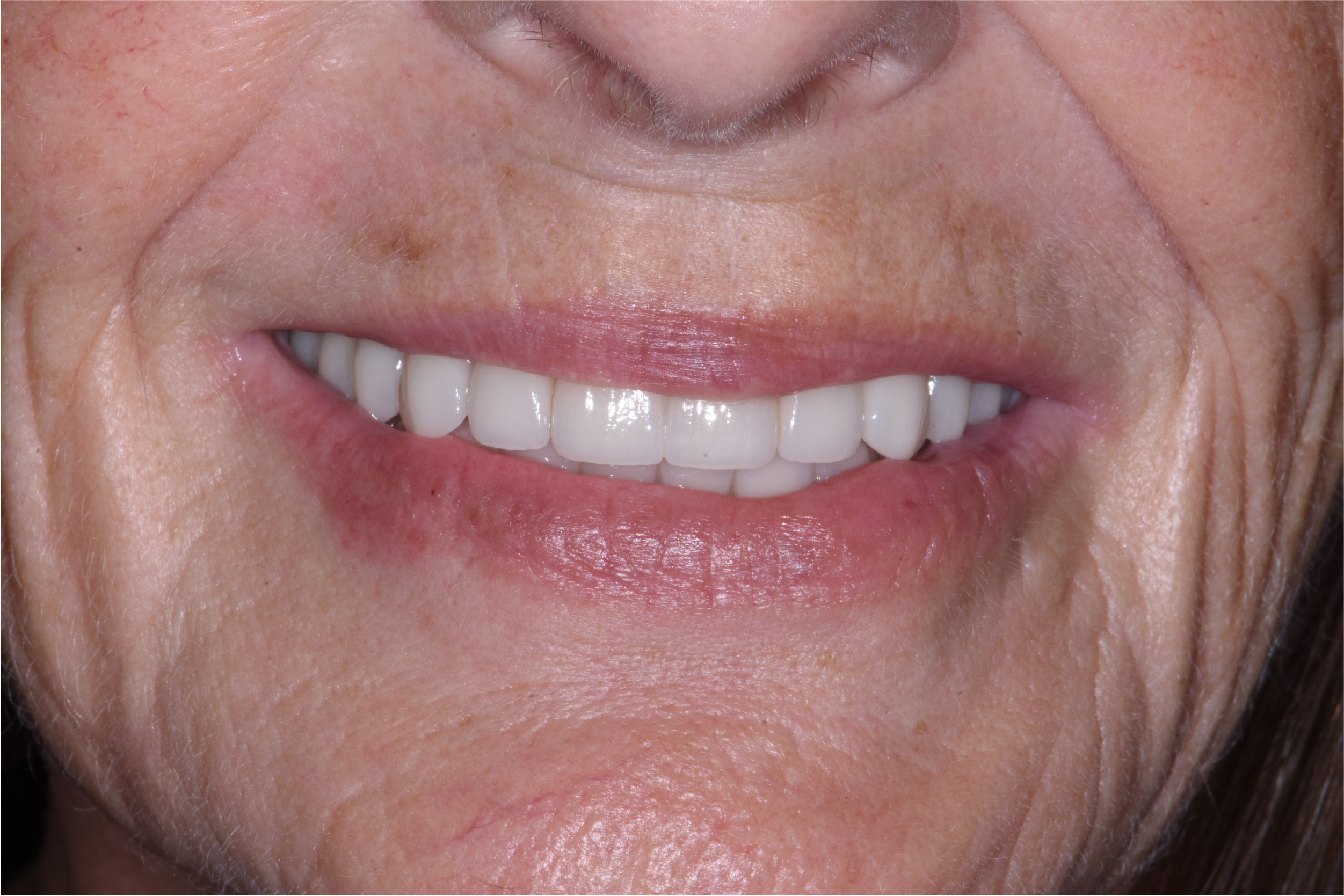Close up of dental patient mouth before and after procedure