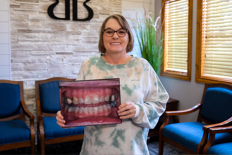 full mouth reconstruction patient