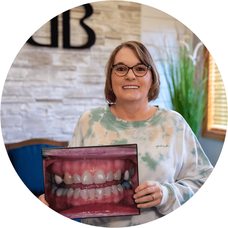 full mouth reconstruction patient