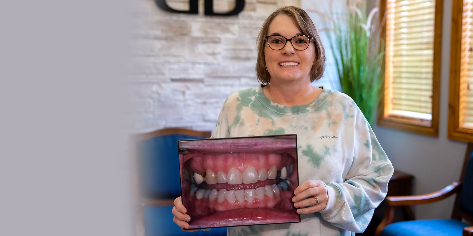 full mouth reconstruction patient