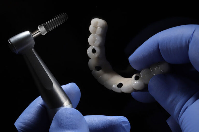 full arch model, dentures model, implant solutions, black background