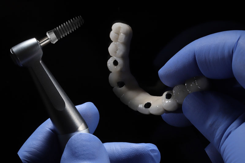 full arch model, dentures model, implant solutions, black background