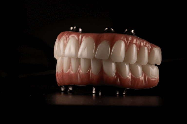 Full arch fixed dental prostheses on dental implant with black background. Zircon bridge on 4 dental implants.