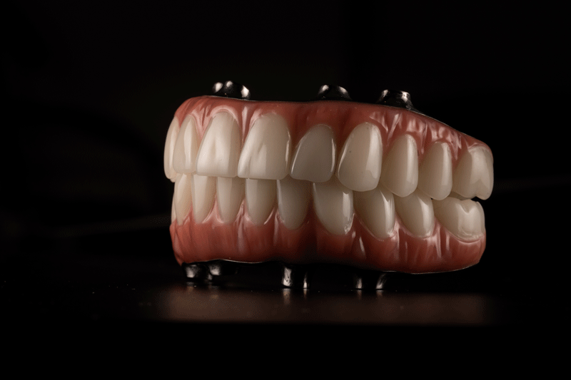 Full arch fixed dental prostheses on dental implant with black background. Zircon bridge on 4 dental implants.