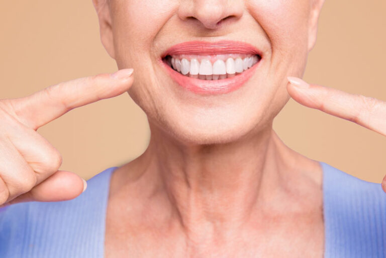 3D illustration of full arch All-on-6 dental implants showing upper and lower implant-supported dentures secured to titanium posts in the jawbone."