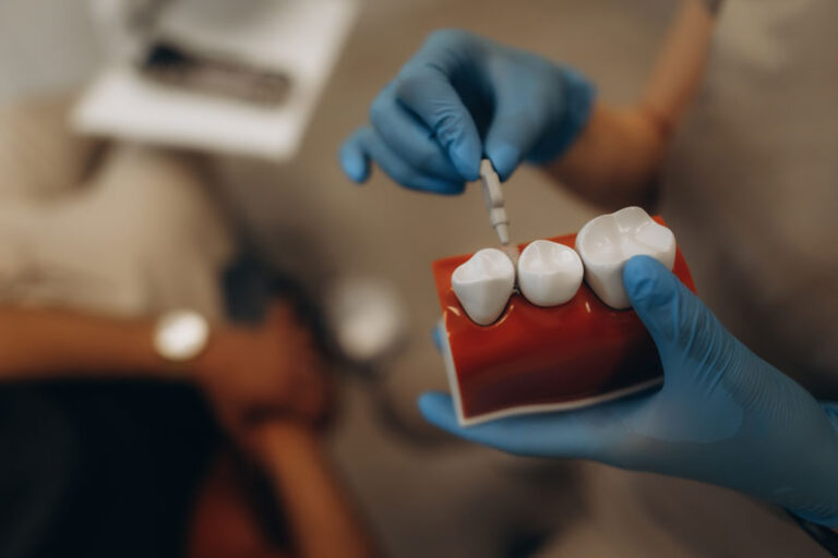 dental implant model, dentist holding a jaw model of a tooth, showing the process of dental implants