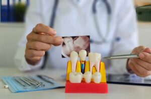 A close-up shot of a smiling senior woman with natural-looking, implant-supported dentures, showcasing confidence and a full set of teeth. No text on the image.